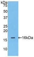 FABP4 / AP2 Antibody (aa2-132, Biotin)