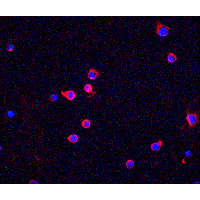 IHC-plus™ CHEK2 / CHK2 Antibody