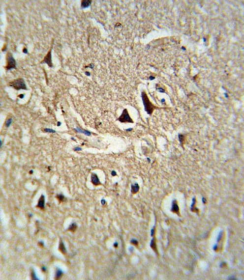 Polyclonal Rabbit anti-Human PCSK2 Antibody (aa318-346, IHC, WB)