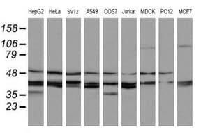 MAP2K3 / MEK3 / MKK3 Antibody (clone OTI6B11, Carrier-free)