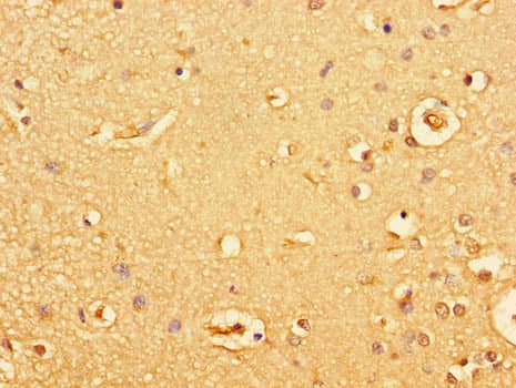 GUCY2C / Guanylyl Cyclase C Antibody