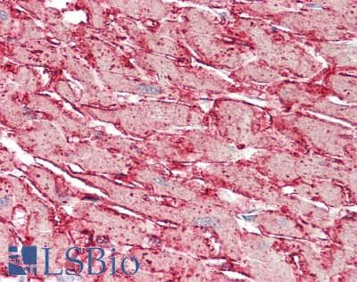 IHC-plus™ CDH4 / R Cadherin Antibody (aa170-428, clone 6H5)