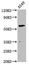 AMH / Anti-Mullerian Hormone Antibody (aa26-560)