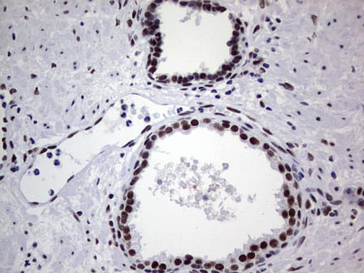 Monoclonal Mouse anti-Human PPP1R8 / Rnase E Antibody (clone OTI4E5, aa1-225, IHC, WB)