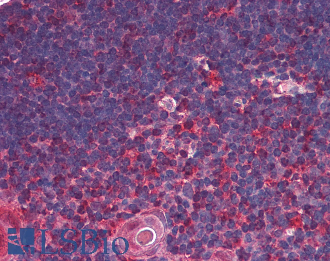 IHC-plus™ TRDMT1 / DNMT2 Antibody (clone 102B1259.2)