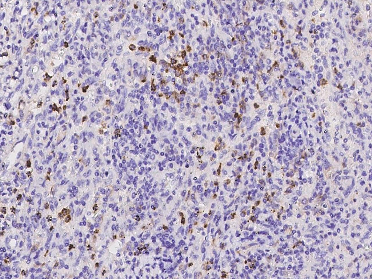 CLEC12A / CD371 Antibody