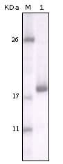 IHC-plus™ DDR2 Antibody (clone 3B11E4)