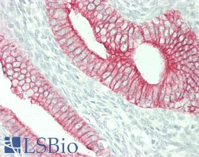IHC-plus™ Monoclonal Mouse anti-Human KRT18 / CK18 / Cytokeratin 18 Antibody (clone CK-18, IHC, WB)