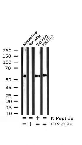 Polyclonal Rabbit anti-Human PPARG / PPAR Gamma Antibody (phospho-Ser112, IHC, IF, WB)