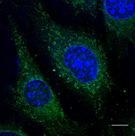 PathPlus™ RAB5A / RAB5 Antibody (C-Terminus)