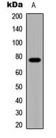 Polyclonal Rabbit anti-Human ADGRG1 / GPR56 Antibody (Internal, WB)
