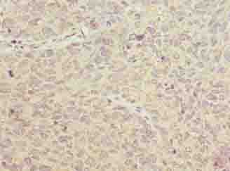 IHC-plus™ PGM2L1 Antibody