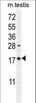 DDIT3 / CHOP Antibody (aa120-149)