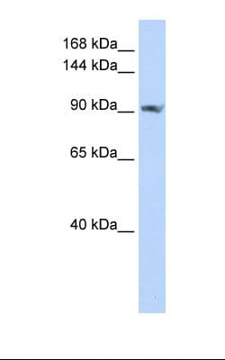 Polyclonal Rabbit anti-Human SCUBE2 Antibody (aa558-607, WB)