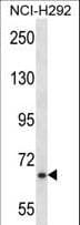 Polyclonal Rabbit anti-Human MYB / c-Myb Antibody (aa419-448, IHC, WB)