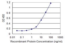 CBFA2T2 / MTGR1 Antibody (clone 2C10)