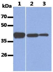 ALDOA / Aldolase A Antibody (clone AT3F9)