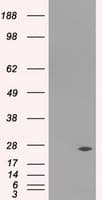 Monoclonal Mouse anti-Human DCXR Antibody (clone OTI7D11, IHC, WB)
