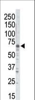 GRK5 Antibody (aa559-590)