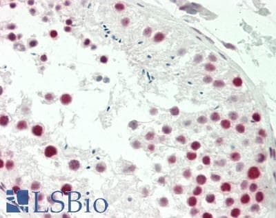IHC-plus™ MAGEA9 Antibody (N-Terminus)