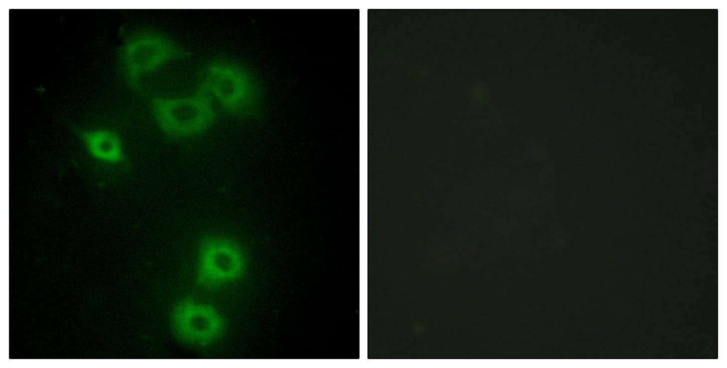 IHC-plus™ ETK / BMX Antibody (aa11-60)