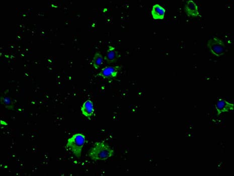 Polyclonal Rabbit anti-Human SLC29A1 / ENT1 Antibody (IHC, IF, WB)