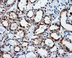 SRR / Serine Racemase Antibody (clone OTI7B6)