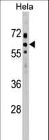 SOCS7 / SOCS-7 Antibody (aa458-486)