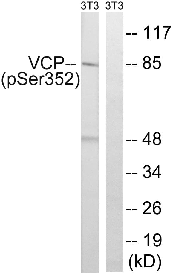 VCP Antibody (phospho-Ser352)