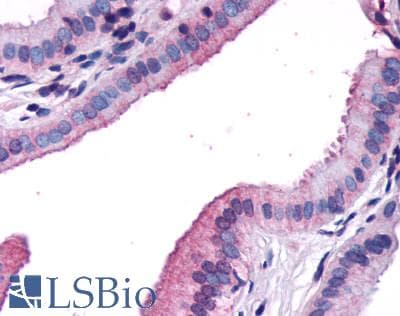 IHC-plus™ Polyclonal Rabbit anti-Human CCKAR / CCK1R Antibody (N-Terminus, IHC)