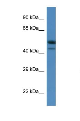 SBK1 Antibody (C-Terminus)