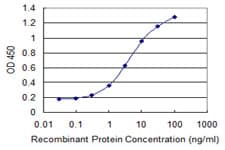 MCCC2 / MCCB Antibody (clone 2B3)