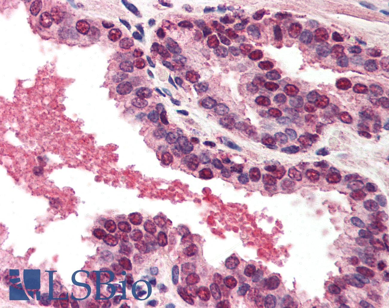 IHC-plus™ DFFA / ICAD / DFF45 Antibody