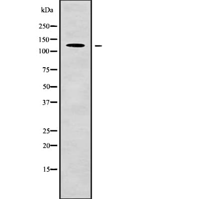 CP / Ceruloplasmin Antibody