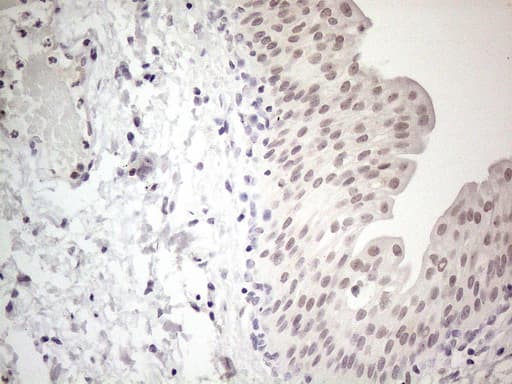 CSA / ERCC8 Antibody (clone OTI2G1, Carrier-free)