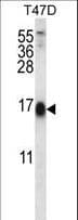 Polyclonal Rabbit anti-Human SKA2 Antibody (aa9-37, IHC, WB)