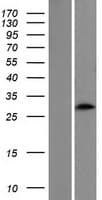 CIDEA / CIDE-A Protein (Over-Expression Lysate Myc-DDK (Flag))