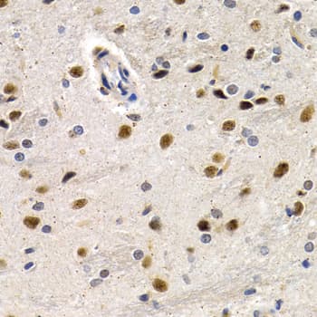 Polyclonal Rabbit anti-Human ID3 Antibody (IHC, IF, WB)