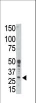 BCL2A1 Antibody (aa30-65)