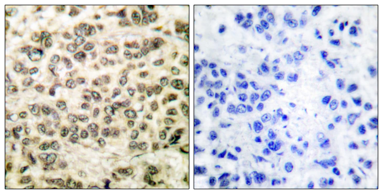 HDAC3 Antibody (aa379-428)