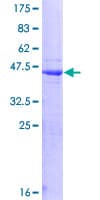 Human HPS / HPS1 Protein (Recombinant GST)