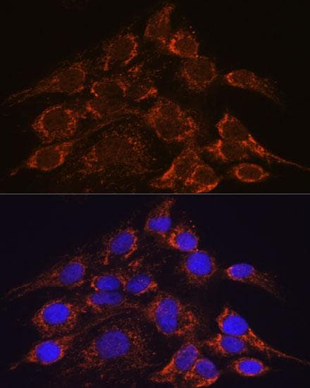 HPS4 Antibody