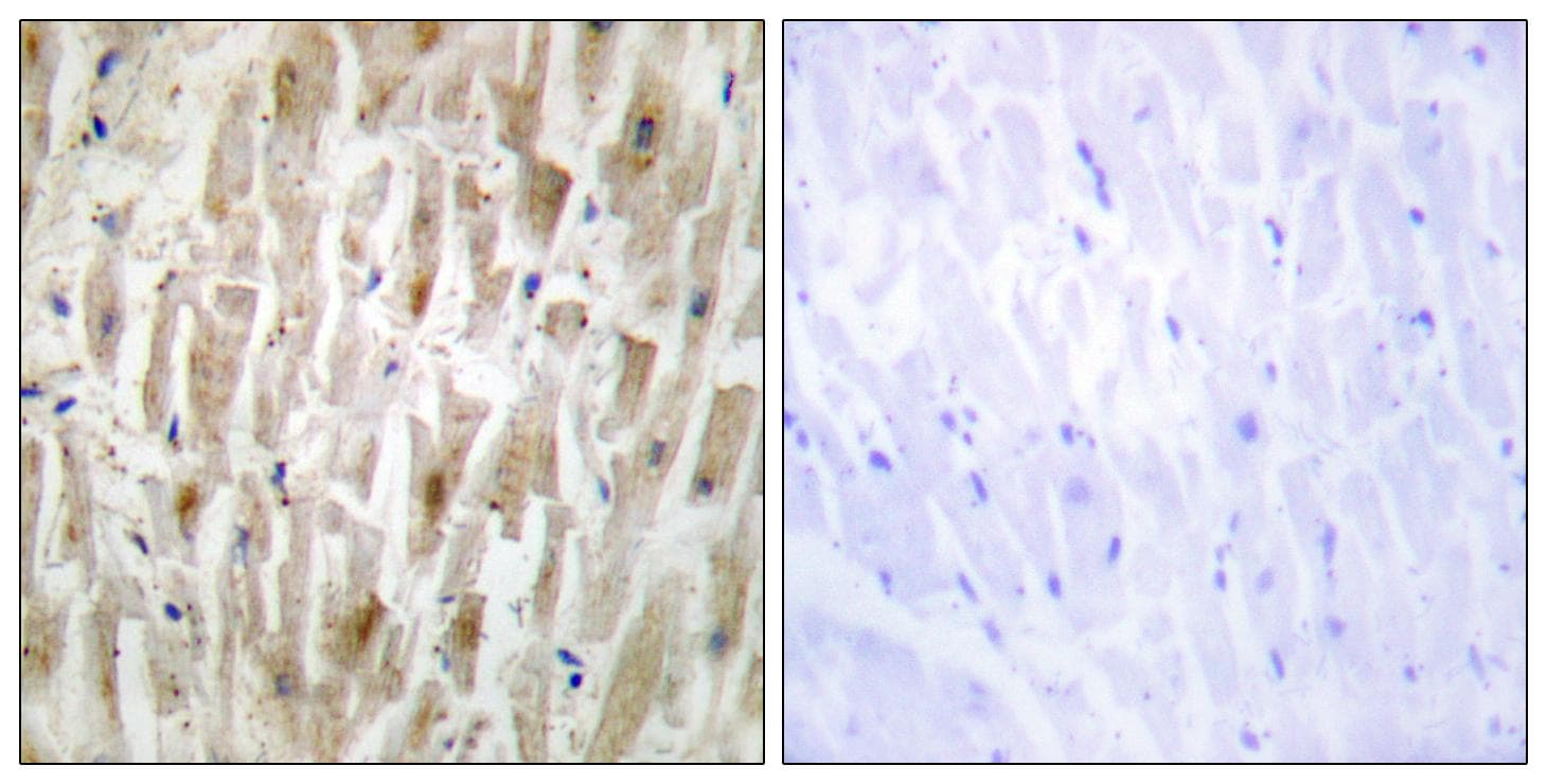 Polyclonal Rabbit anti-Human LIMK2 Antibody (IHC, IF, WB)