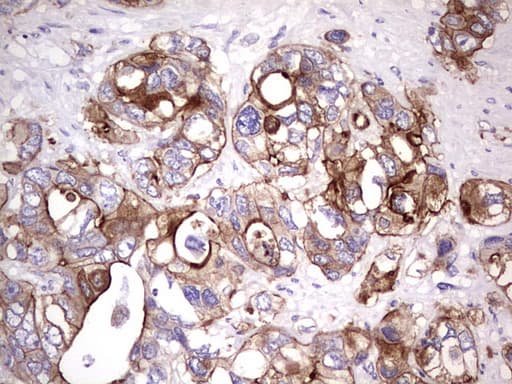 CD30 Antibody (aa19-379, clone OTI2G7)