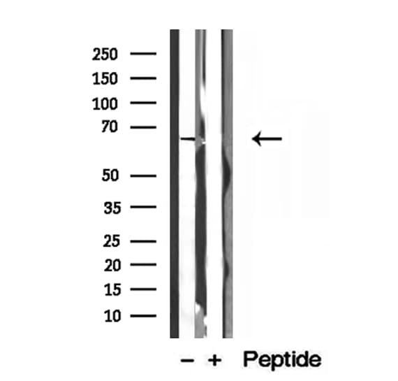 Polyclonal Rabbit anti-Human MTA3 Antibody (IHC, IF, WB)