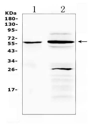 TNFRSF1A / TNFR1 Antibody