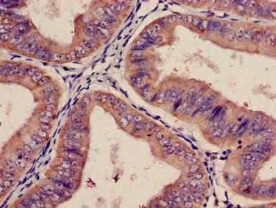 ITGA2 / CD49b Antibody