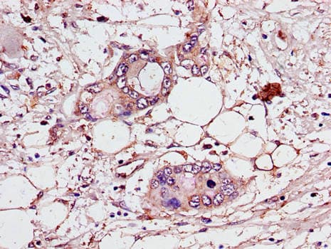 CEP70 Antibody