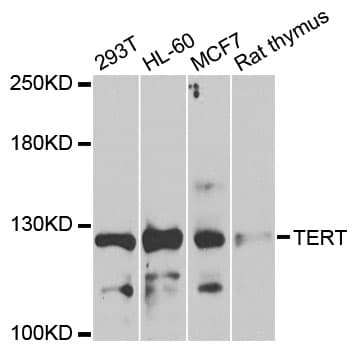 TERT / Telomerase Antibody