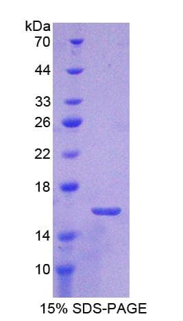 Rat ATP5J Protein (Recombinant His-T7)